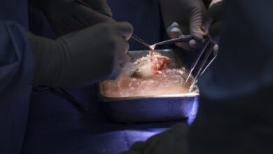 Surgeons perform first xenotransplant using CRISPR’d pig kidney