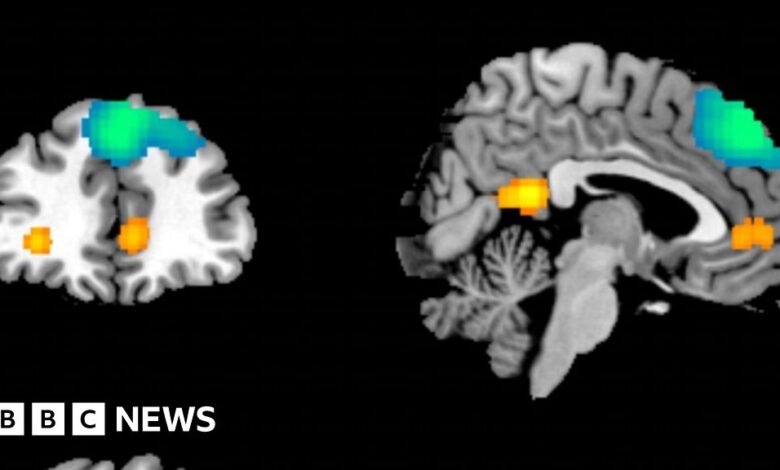 Essex University’s AI brain study brings ‘hope’ to childhood trauma survivors Essex University’s AI brain study brings ‘hope’ to childhood trauma survivors