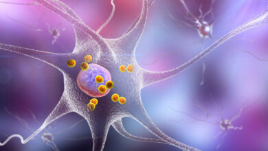 GLP-1 drug may help with Parkinson’s disease, study reports