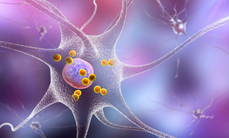GLP-1 drug may help with Parkinson’s disease, study reports GLP-1 drug may help with Parkinson’s disease, study reports