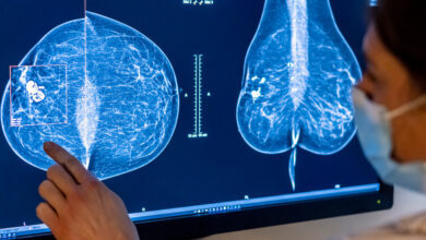 Are AI Mammograms Worth the Cost?