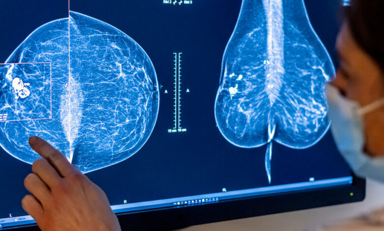 Are AI Mammograms Worth the Cost? Are AI Mammograms Worth the Cost?