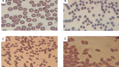 The Evaluation of Artificial Intelligence Technology for the Differentiation of Fresh Human Blood Cells From Other … – Cureus