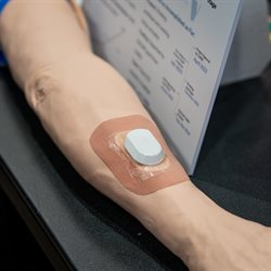 &amp;lt;em&amp;gt;Auvi seeks to provide continuous fistula monitoring for end-stage renal disease patients with an arteriovenous fistula. The product will use a patch-like sensor to collect auditory information to monitor for&amp;amp;nbsp;AVF narrowing, thus informing clinical decision-making, reducing healthcare costs, and improving patient outcomes.&amp;lt;/em&amp;gt;