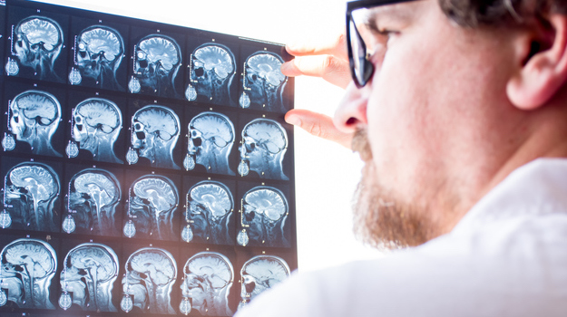 AbbVie, NeuroDerm Heat Up Levodopa Competition with New Data at AAN24 AbbVie, NeuroDerm Heat Up Levodopa Competition with New Data at AAN24