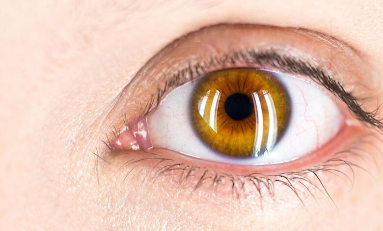 Artificial intelligence outperforms doctors in the precise diagnosis of eye disorders Artificial intelligence outperforms doctors in the precise diagnosis of eye disorders