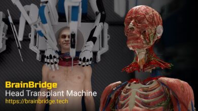 Robots Could One Day Conduct Head Transplants with BrainBridge : Health : Tech Times