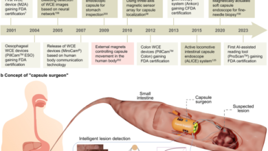 Robotic wireless capsule endoscopy: recent advances and upcoming technologies