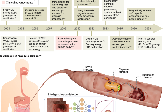 Robotic wireless capsule endoscopy: recent advances and upcoming technologies Robotic wireless capsule endoscopy: recent advances and upcoming technologies