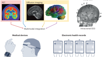 Artificial intelligence in epilepsy — applications and pathways to the clinic