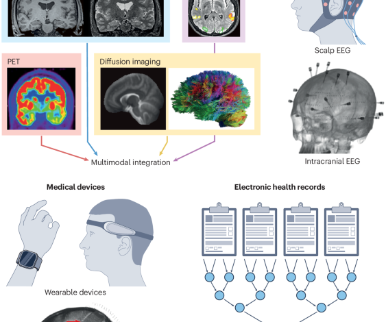 Artificial intelligence in epilepsy — applications and pathways to the clinic Artificial intelligence in epilepsy — applications and pathways to the clinic
