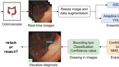 Establishment and validation of an artificial intelligence-based model for real-time detection and classification of colorectal adenoma