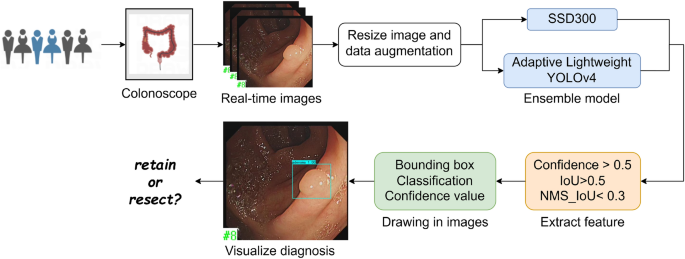 Establishment and validation of an artificial intelligence-based model for real-time detection and classification of colorectal adenoma Establishment and validation of an artificial intelligence-based model for real-time detection and classification of colorectal adenoma