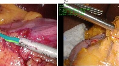 Laparoscopic distal gastrectomy skill evaluation from video: a new artificial intelligence-based instrument identification system