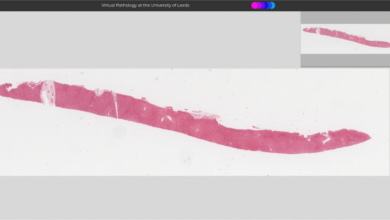 Artificial intelligence in digital pathology: a systematic review and meta-analysis of diagnostic test accuracy