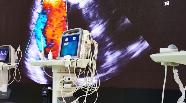 We’re Keeping An Eye On ReWalk Robotics’ (NASDAQ:LFWD) Cash Burn Rate We’re Keeping An Eye On ReWalk Robotics’ (NASDAQ:LFWD) Cash Burn Rate