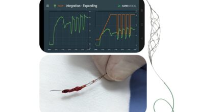 Rapid Medical completes successful stroke procedures with “world’s first” robotic thrombectomy device