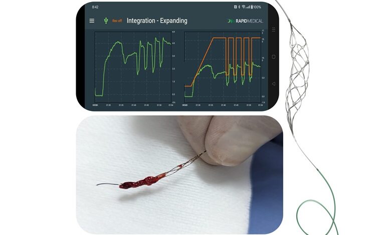 Rapid Medical completes successful stroke procedures with “world’s first” robotic thrombectomy device Rapid Medical completes successful stroke procedures with “world’s first” robotic thrombectomy device