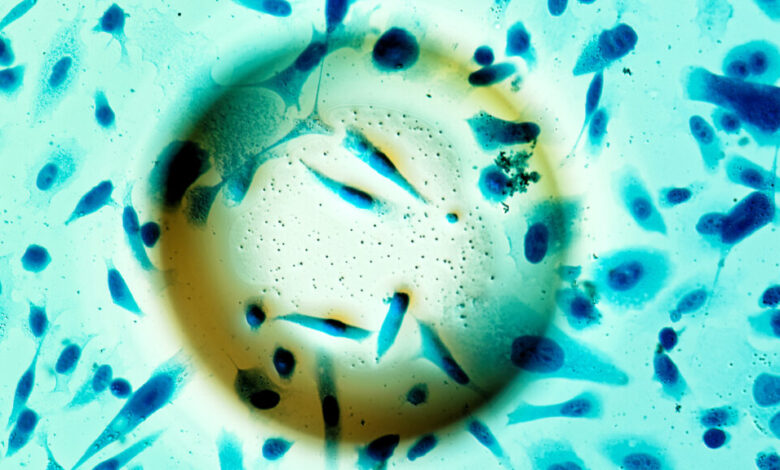 J&J reports mixed data on next-generation radiopharmaceutical J&J reports mixed data on next-generation radiopharmaceutical