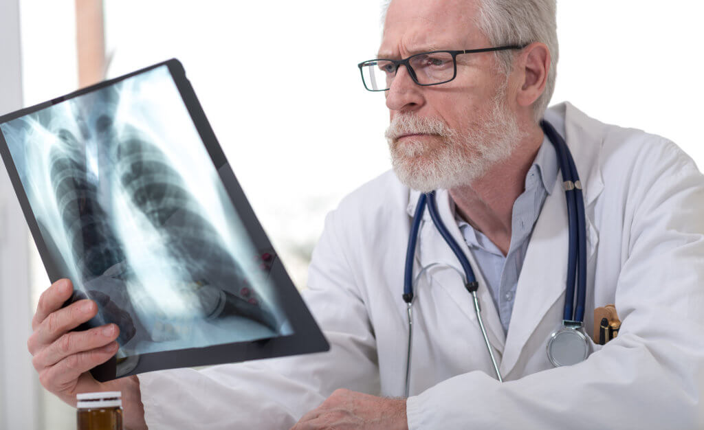 Doctor looking at x-ray of lungs