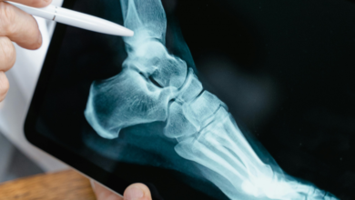 AI model for ankle stress radiography could reduce radiologists' workload by average of 70% – Radiology Business