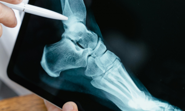 AI model for ankle stress radiography could reduce radiologists' workload by average of 70% – Radiology Business AI model for ankle stress radiography could reduce radiologists' workload by average of 70% – Radiology Business