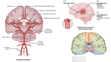 The Role of Artificial Intelligence-Powered Imaging in Cerebrovascular Accident Detection – Cureus