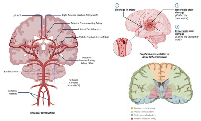 The Role of Artificial Intelligence-Powered Imaging in Cerebrovascular Accident Detection – Cureus