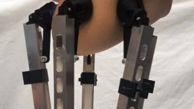 ‘Manipulator’ robot could bring accurate breast cancer exams to clinics and pharmacies –