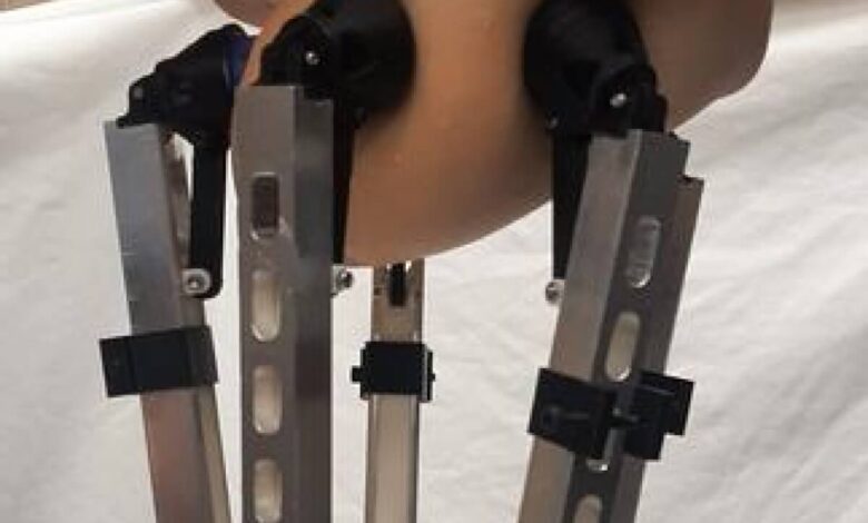 ‘Manipulator’ robot could bring accurate breast cancer exams to clinics and pharmacies – ‘Manipulator’ robot could bring accurate breast cancer exams to clinics and pharmacies –