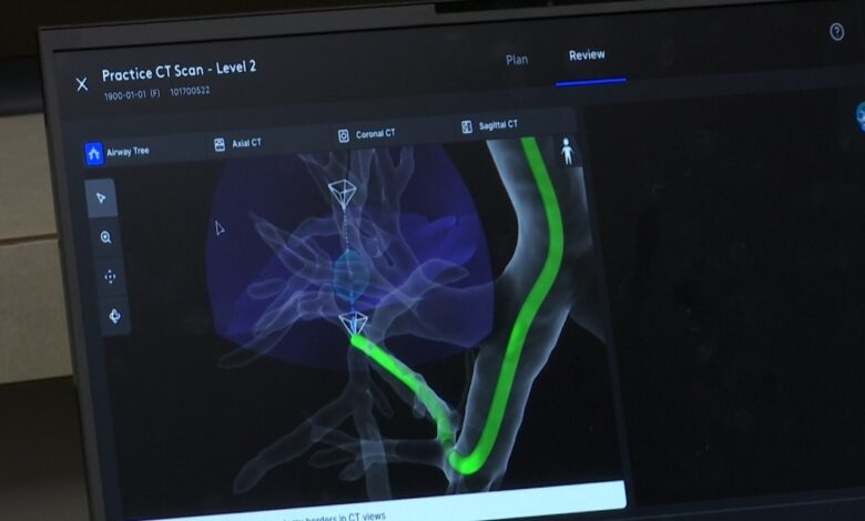 Ion Robotic Technology now offered at Bismarck Sanford Ion Robotic Technology now offered at Bismarck Sanford