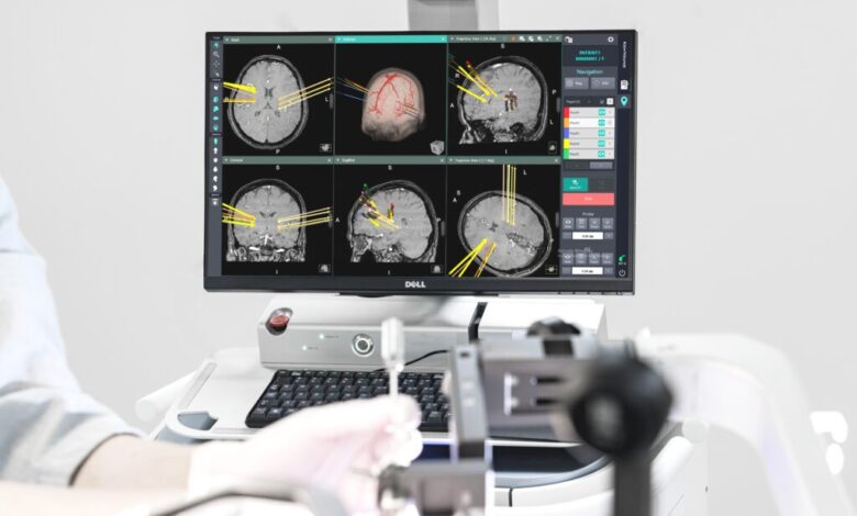 Korea’s Koh Young to launch brain surgery robot in US in 2025 Korea’s Koh Young to launch brain surgery robot in US in 2025