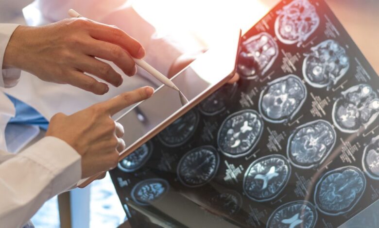 Biomedical Engineering’s Shuo Li explores health benefits of artificial intelligence Biomedical Engineering’s Shuo Li explores health benefits of artificial intelligence