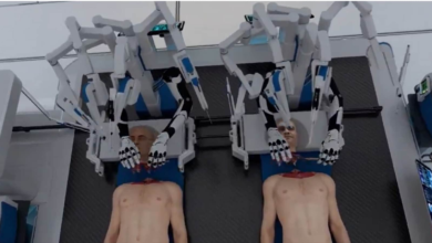 World’s first head transplant with robotic surgeons? Startup claims ‘revolutionary’ procedure | Trending