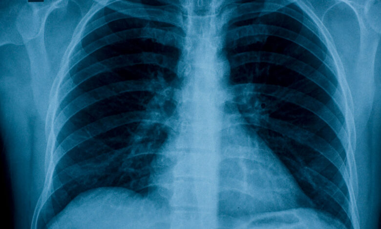 AI could take medical imaging to the next level – Science News Magazine AI could take medical imaging to the next level – Science News Magazine