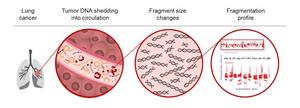 Artificial intelligence blood test provides a