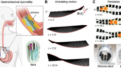 Robotic device restores wavelike muscular function involved in processes like digestion