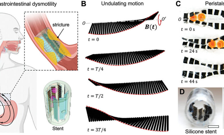 Robotic device restores wavelike muscular function involved in processes like digestion Robotic device restores wavelike muscular function involved in processes like digestion