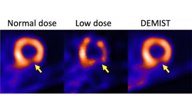 Artificial intelligence tool may enhance usability of medical images