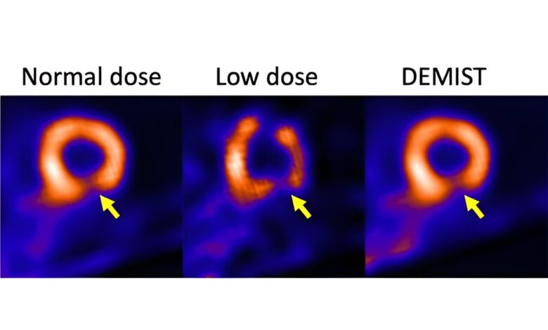 Artificial intelligence tool may enhance usability of medical images Artificial intelligence tool may enhance usability of medical images