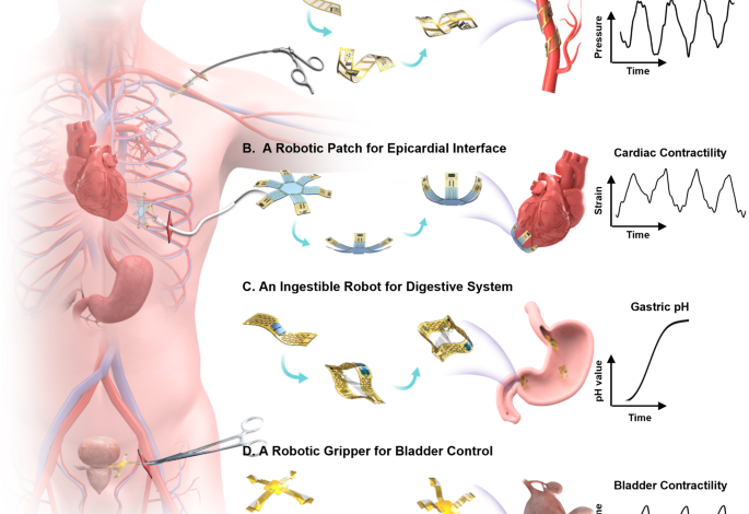 Skin-inspired, sensory robots for electronic implants Skin-inspired, sensory robots for electronic implants