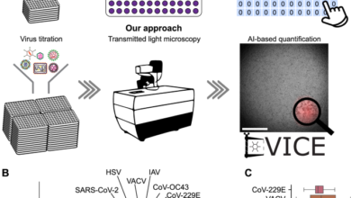 A versatile automated pipeline for quantifying virus infectivity by label-free light microscopy and artificial intelligence