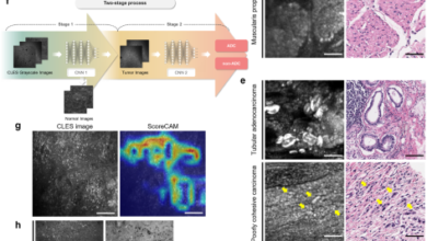 Artificial intelligence-based real-time histopathology of gastric cancer using confocal laser endomicroscopy