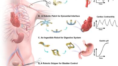 Revolutionizing Medical Implants with Soft Robotics