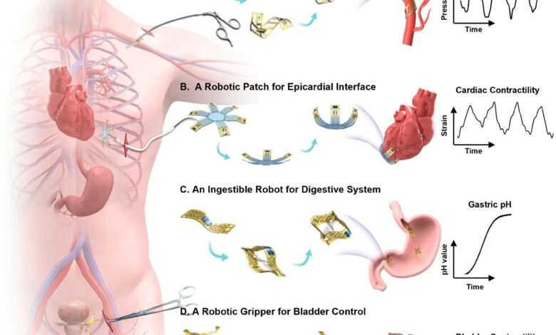 Revolutionizing Medical Implants with Soft Robotics Revolutionizing Medical Implants with Soft Robotics