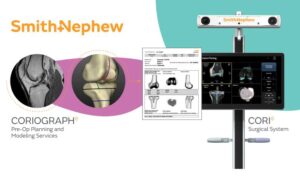 Smith+Nephew CorioGraph pre-operative planning and modeling services