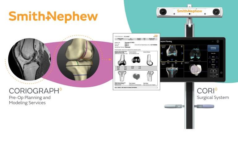 Smith+Nephew launches pre-op planning tech for surgical robotics Smith+Nephew launches pre-op planning tech for surgical robotics