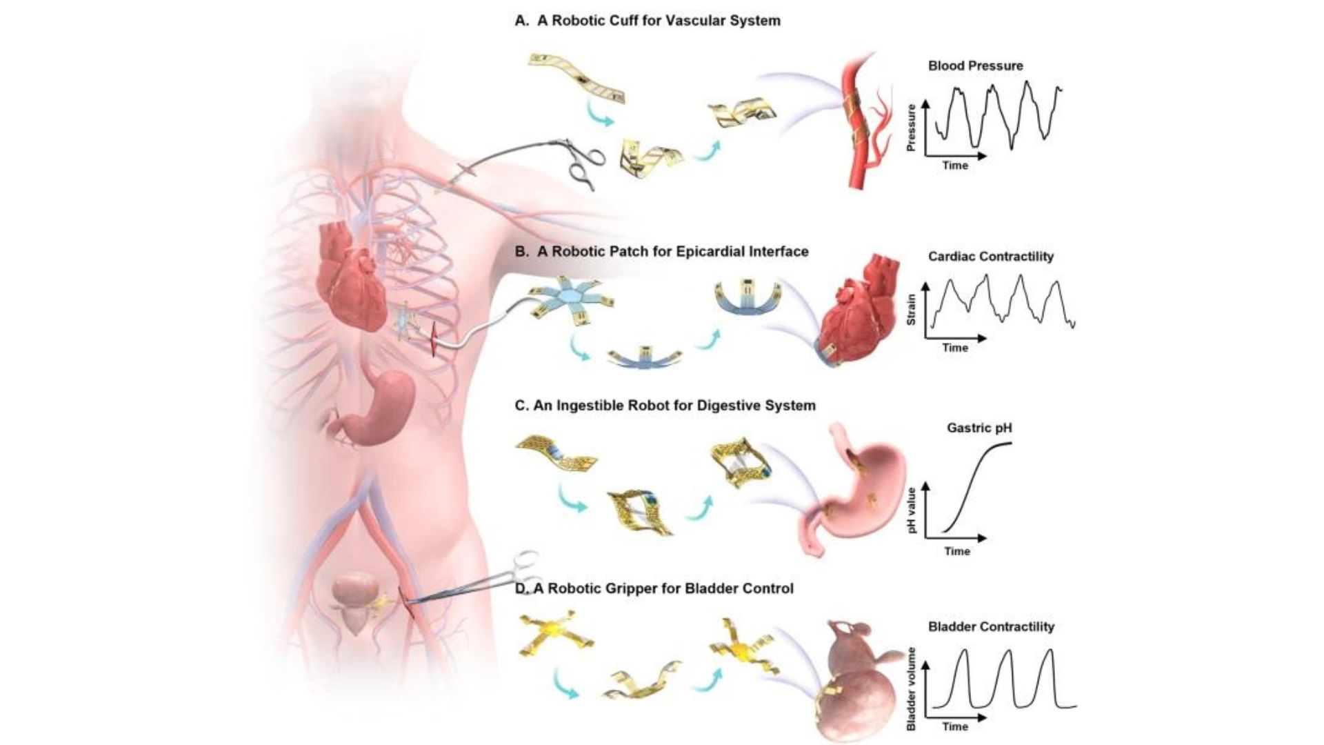 Robotic cuff detects blood pressure; heart patch monitors in real-time; ingestible robot stays in stomach; gripper controls bladder volume.