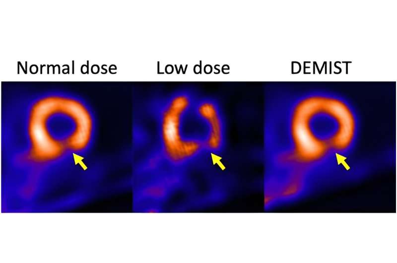 Artificial intelligence tool may enhance usability of medical images