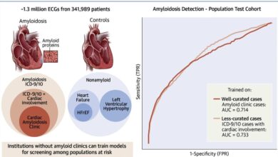 Using ECG AI to find the cardiac amyloidosis needles in the haystack